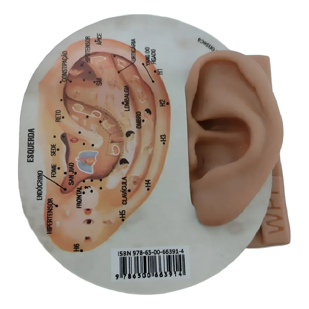 Gabarito Acupuntura Auricular e Auriculoterapia Prof. Wagner Fonseca - 5 un